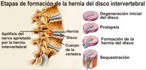 ¿Cómo se aplica?